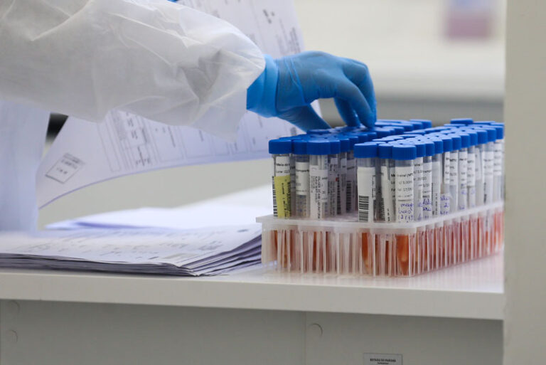 Óbitos por Covid-19 aumentam 70% em uma semana no Piauí; casos confirmados dobram