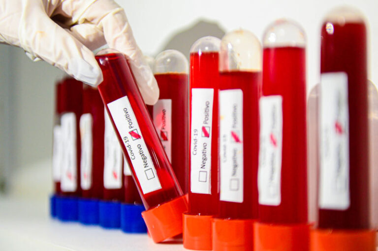 Piauí registra quase 900 novos casos de covid em 24h, diz Sesapi