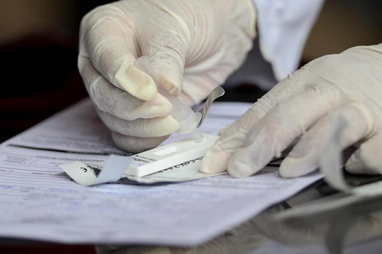Piauí registra 1.250 casos de covid e 13 óbitos em 24 horas