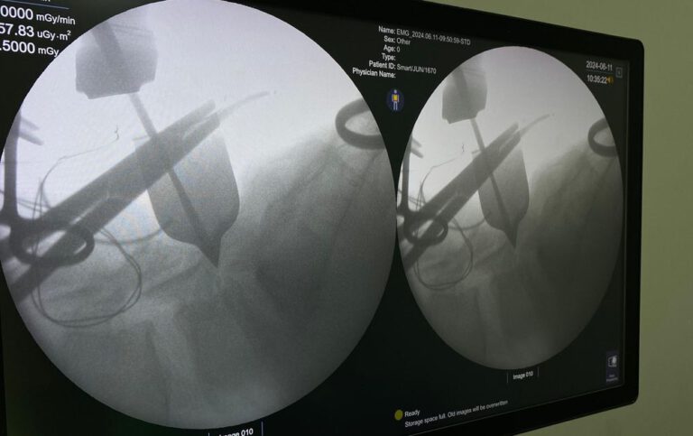 Hospital Regional Justino Luz realiza primeira cirurgia de coluna por vídeo